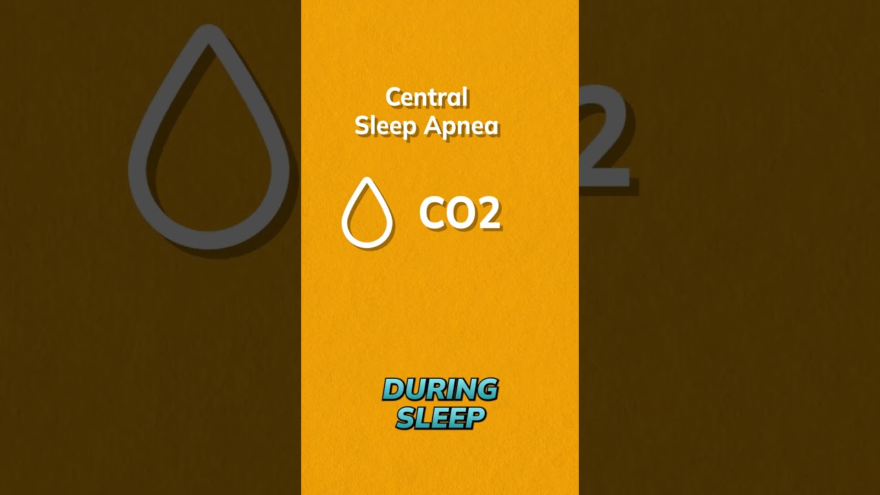 Central Sleep Apnea and "The Wakefulness Drive to Breathe"
