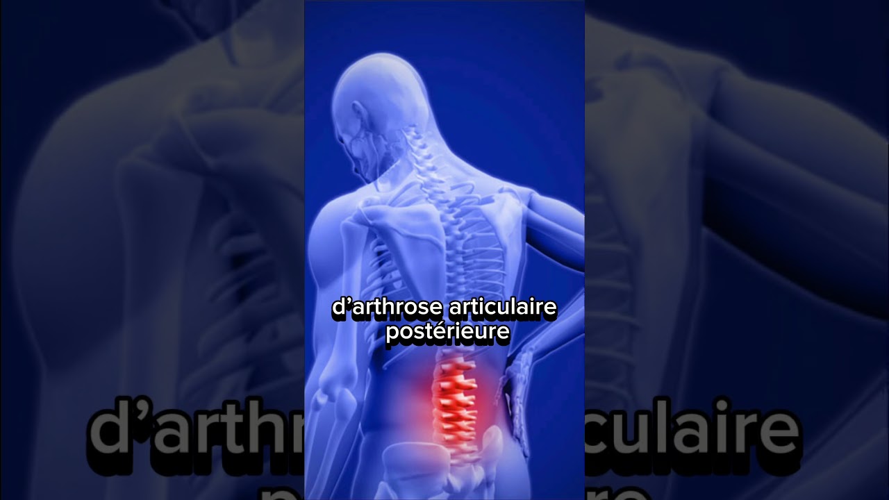 Est-ce que les infiltrations sont efficaces quand on a mal au dos ?