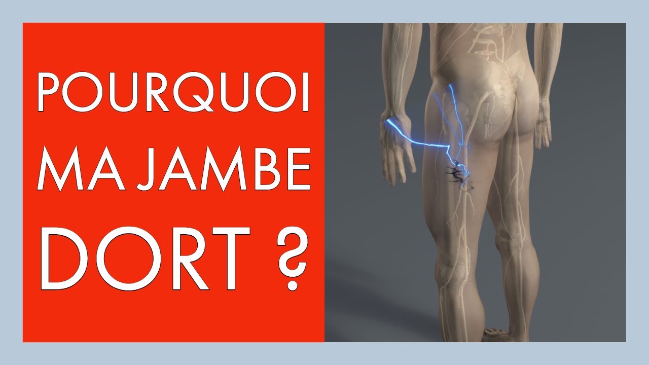 Sciatique: Perte de sensibilité, fourmillements jambe ou pied: pourquoi ma jambe dort ?