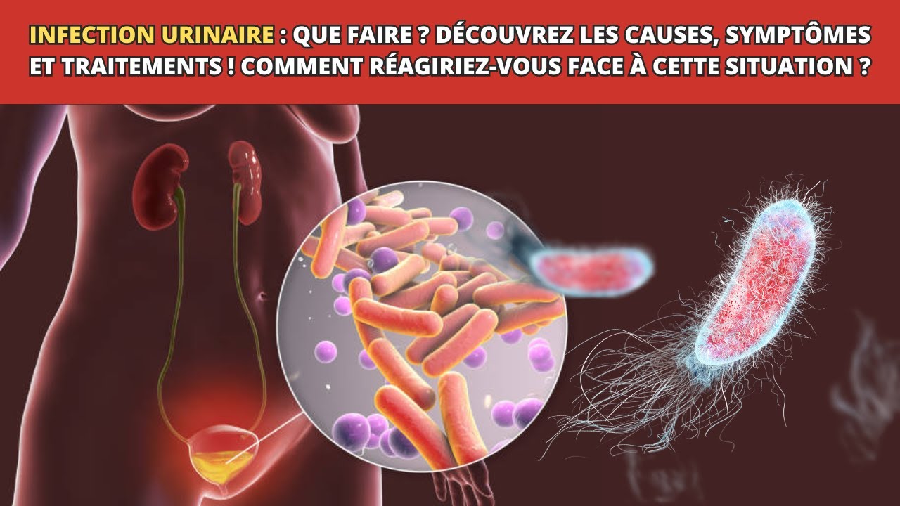 Guide complet sur les infections urinaires : Causes, Symptômes, Traitement et Prévention