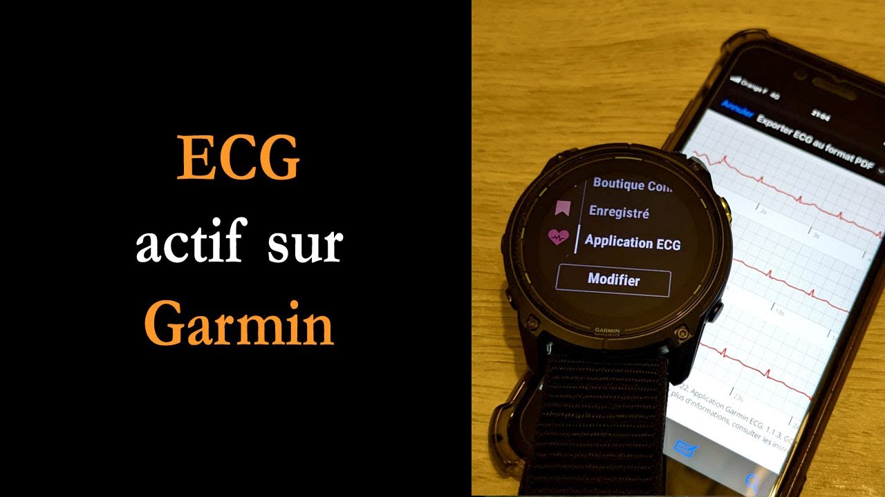 L'ECG enfin actif sur les montres Garmin en France !