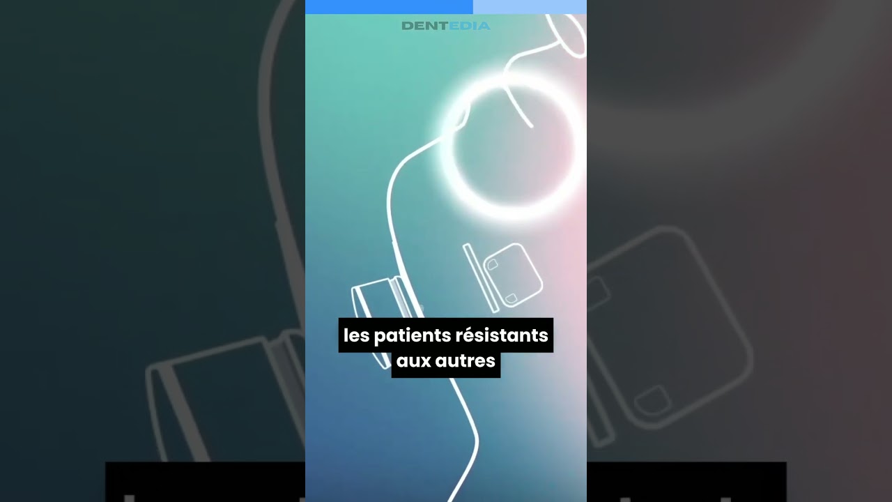 Ce nouvel implant pourrait révolutionner le traitement de l’apnée du sommeil