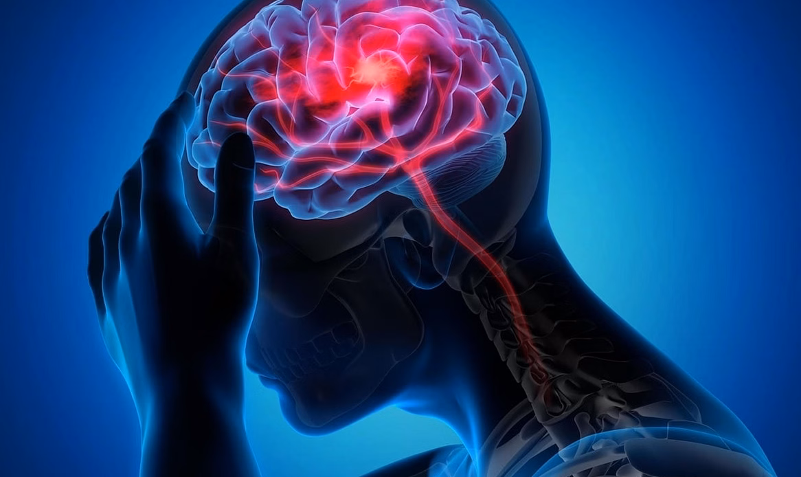 Malformation de Chiari : anomalie cérébrale rare et traitement
